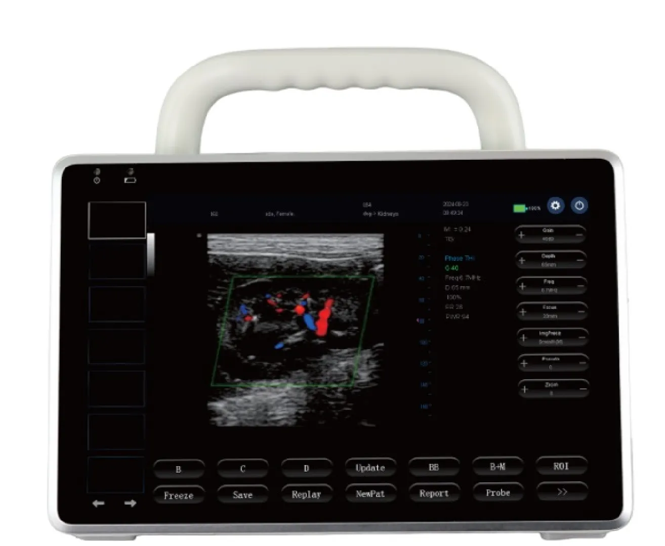 P10 Tablet Ultrason